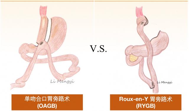 糖尿病治疗研究中心(糖尿病治疗研究综述)