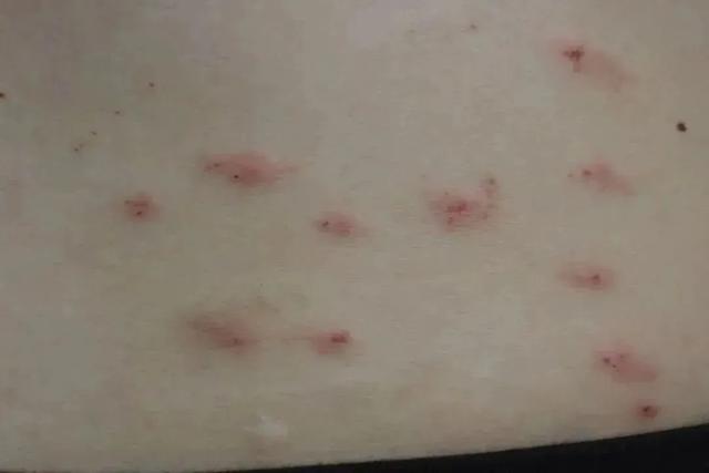 一觉醒来有腋臭(一觉醒来有腋臭味道)
