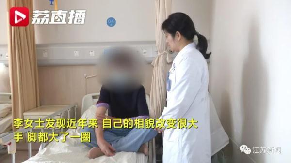 异变糖尿病(异形糖尿病是什么意思)