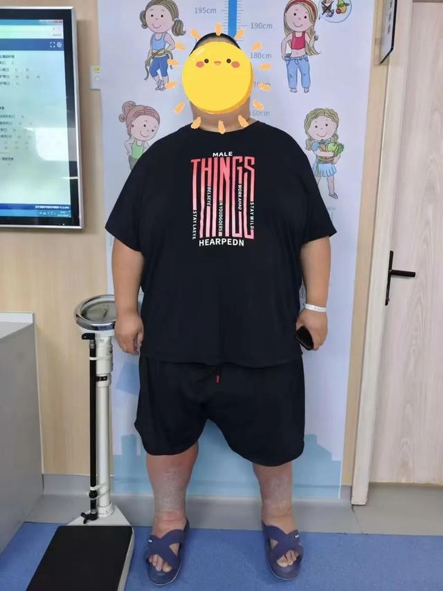 合肥肥胖(合肥肥胖门诊)