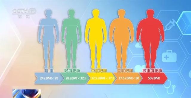 肥胖症患者减肥食谱(肥胖症患者减肥能减肥吗)
