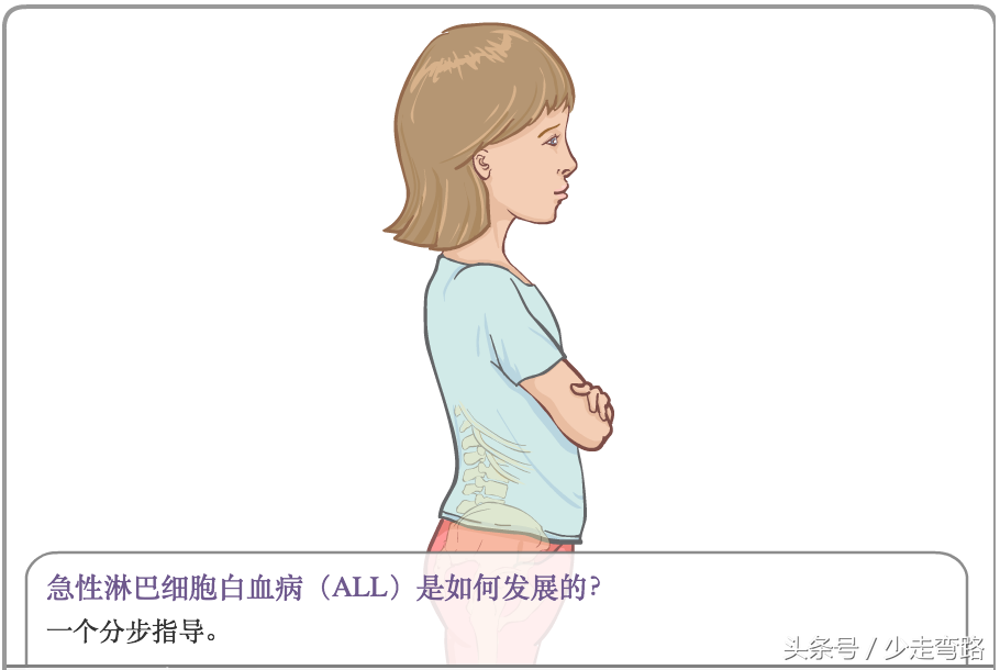 急性淋巴细胞白血病 10种最难治的白血病