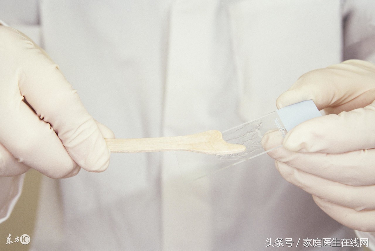 子宫癌的早期症状 子宫癌晚期还能活多久