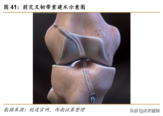 医药行业专题报告之骨科行业深度研究
