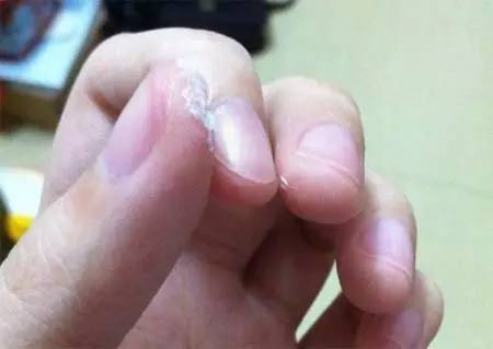 502胶水怎么洗掉 教你一秒清除502胶水