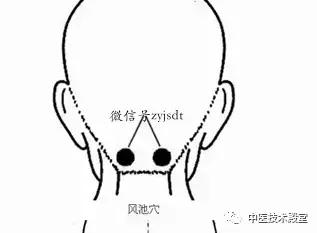 关元的准确位置图 关元穴最简单找法