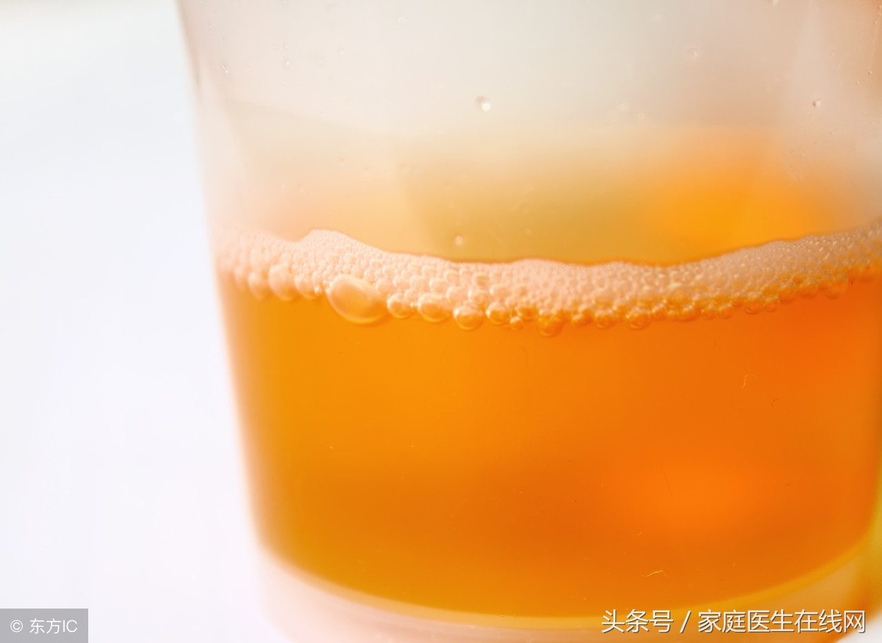小便发黄是什么原因 长期尿黄是怎么回事