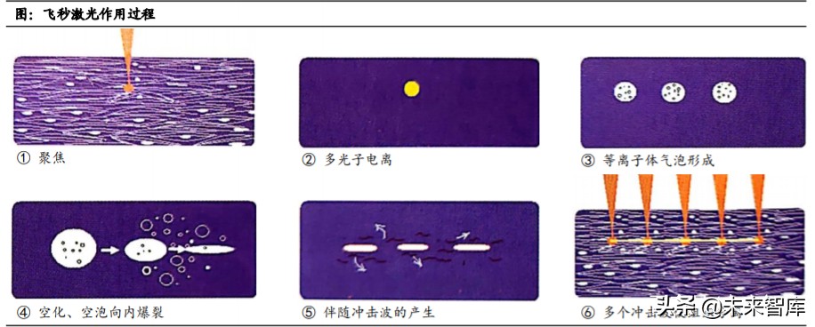 眼科產業鏈深度報告：創新驅動，服務為王