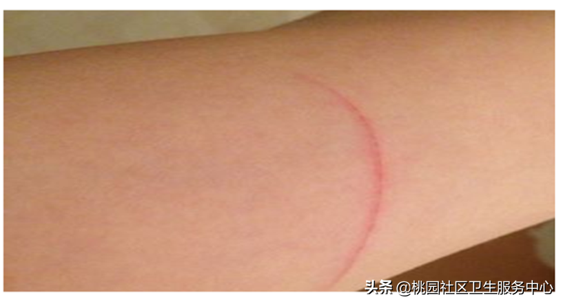 狂犬疫苗打几针 央视辟谣狂犬病