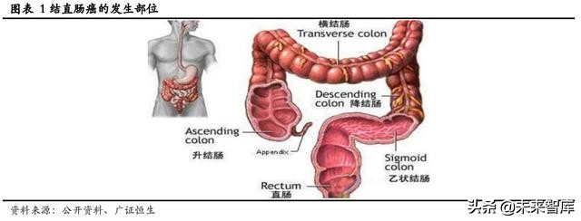 肠癌早筛专题报告：基于DNA的筛查技术引领肠癌早筛迈入新时代