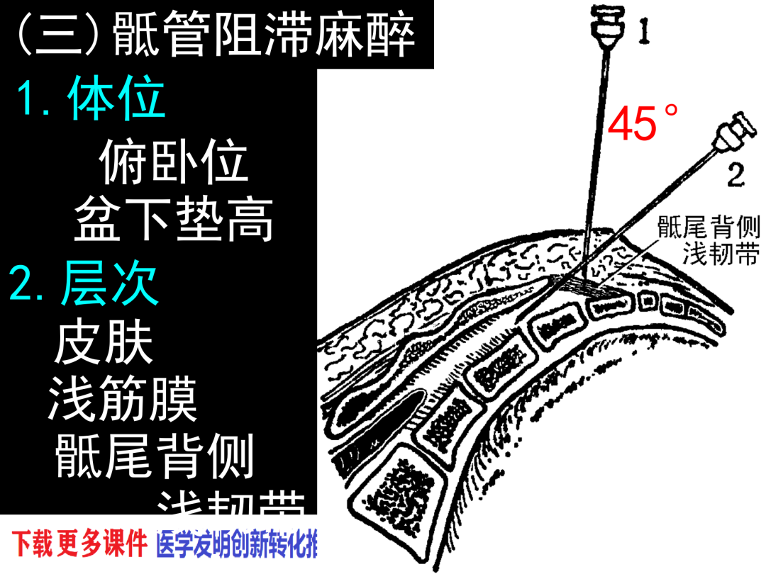 蛛网膜和软脊膜之间的实体腔隙,充满脑脊液,以阻滞该部位的神经根
