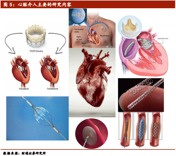 医疗介入器械行业深度报告