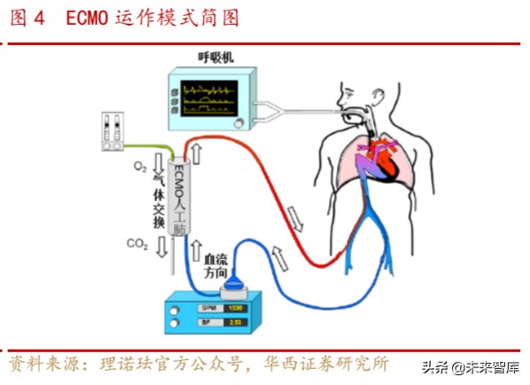 医疗急救设备行业专题报告：ICU必备设备ECMO紧缺