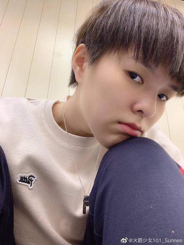 额头长痘怎么回事 额头长痘什么原因