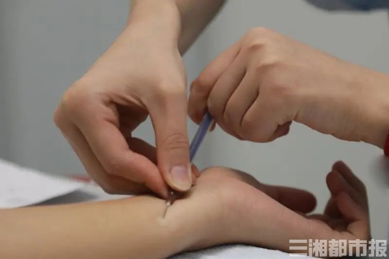 结核菌素试验 憋气60秒自查肺结核