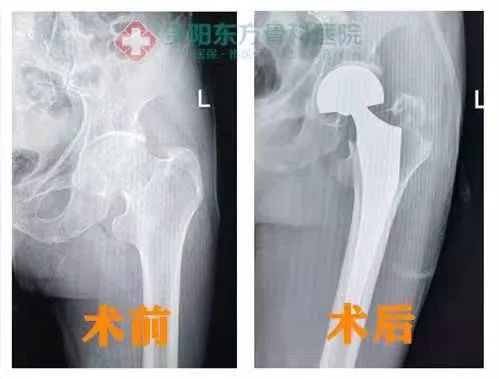 贵阳东方骨科医院 贵阳最有名的骨科医院