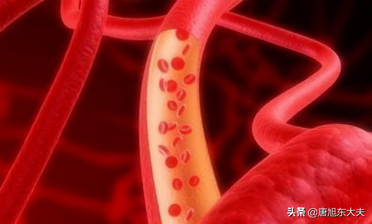 血小板计数偏高 血小板偏高原因小孩