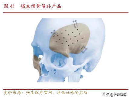 骨科行业深度报告：水大鱼大，老龄化与政策驱动