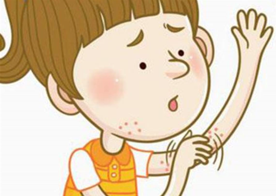 胆碱能性荨麻疹 荨麻疹图片症状图片