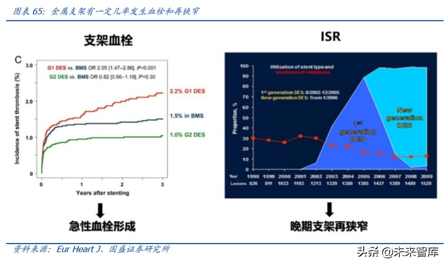 乐普医疗深度解析：布局心血管医疗全产业链，不断创新发展