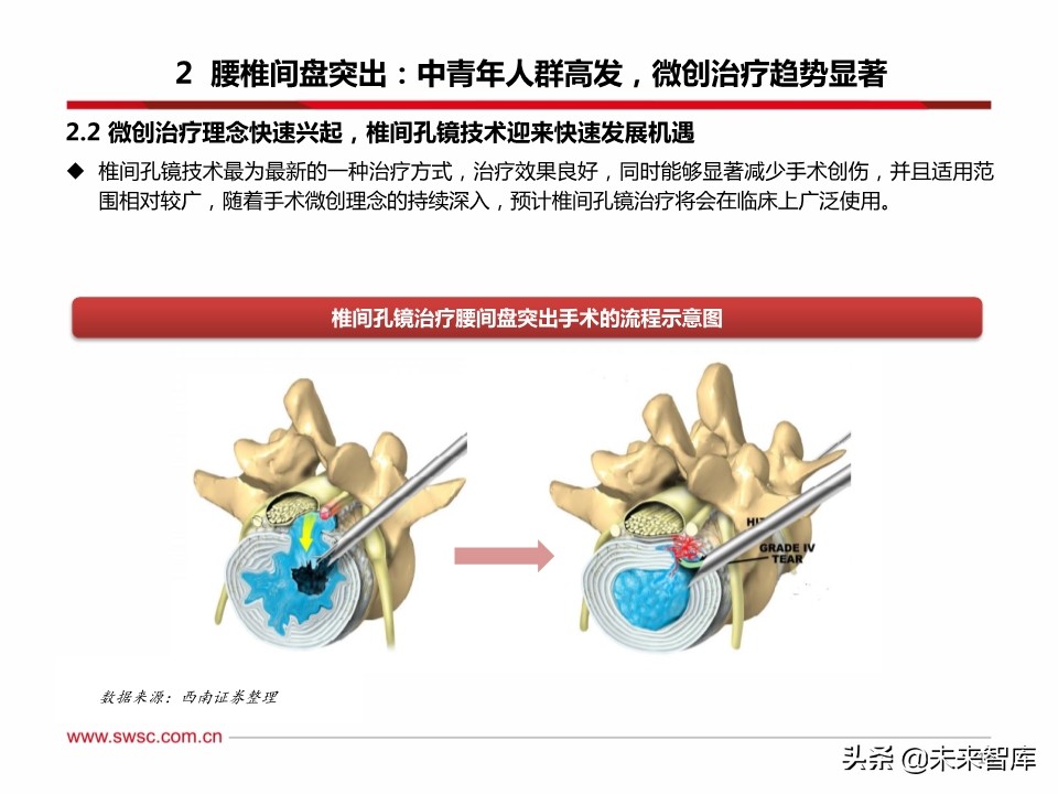 医药行业之骨科专题报告：脊柱微创手术发展机遇分析