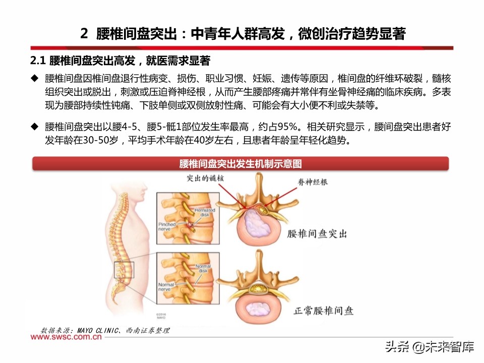 医药行业之骨科专题报告：脊柱微创手术发展机遇分析