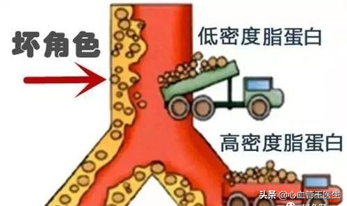 低密度脂蛋白胆固醇 低密度脂蛋白胆固醇偏高怎么办