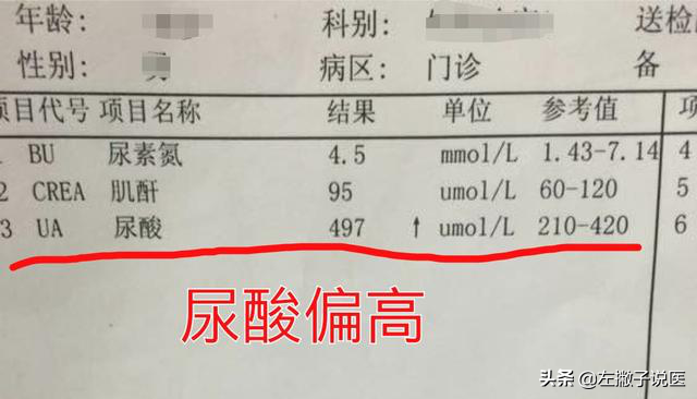 尿酸正常值是多少 肌酐正常值范围