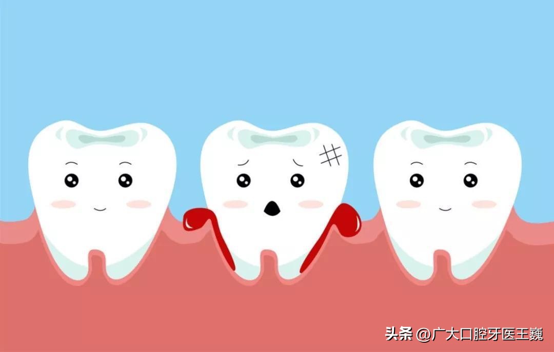 牙龈出血是什么原因 牙龈出血要警惕三种病