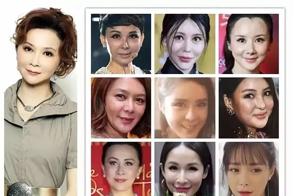 女人10处有痣是富贵痣 女人身上最有钱的痣