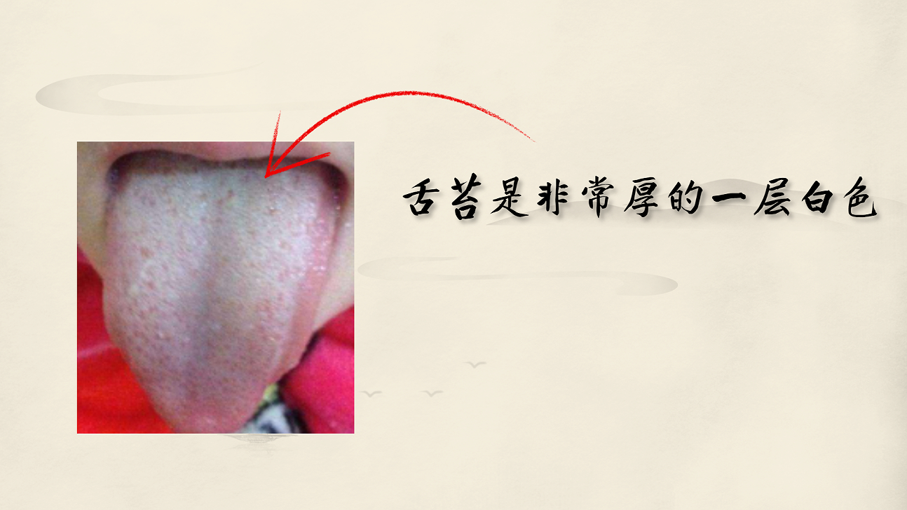 藿香清胃胶囊的作用 藿香清胃胶囊能常吃吗