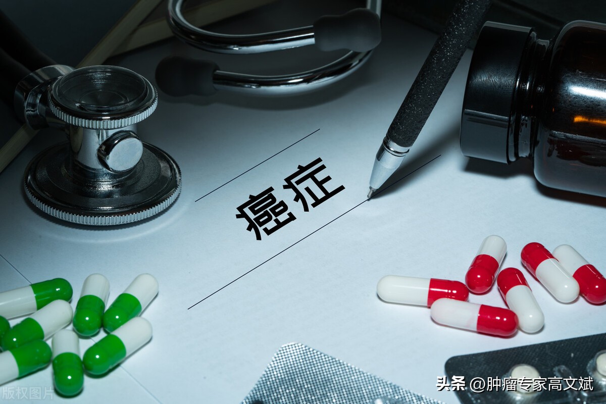 五十步笑百步 50步笑百步的寓言故事
