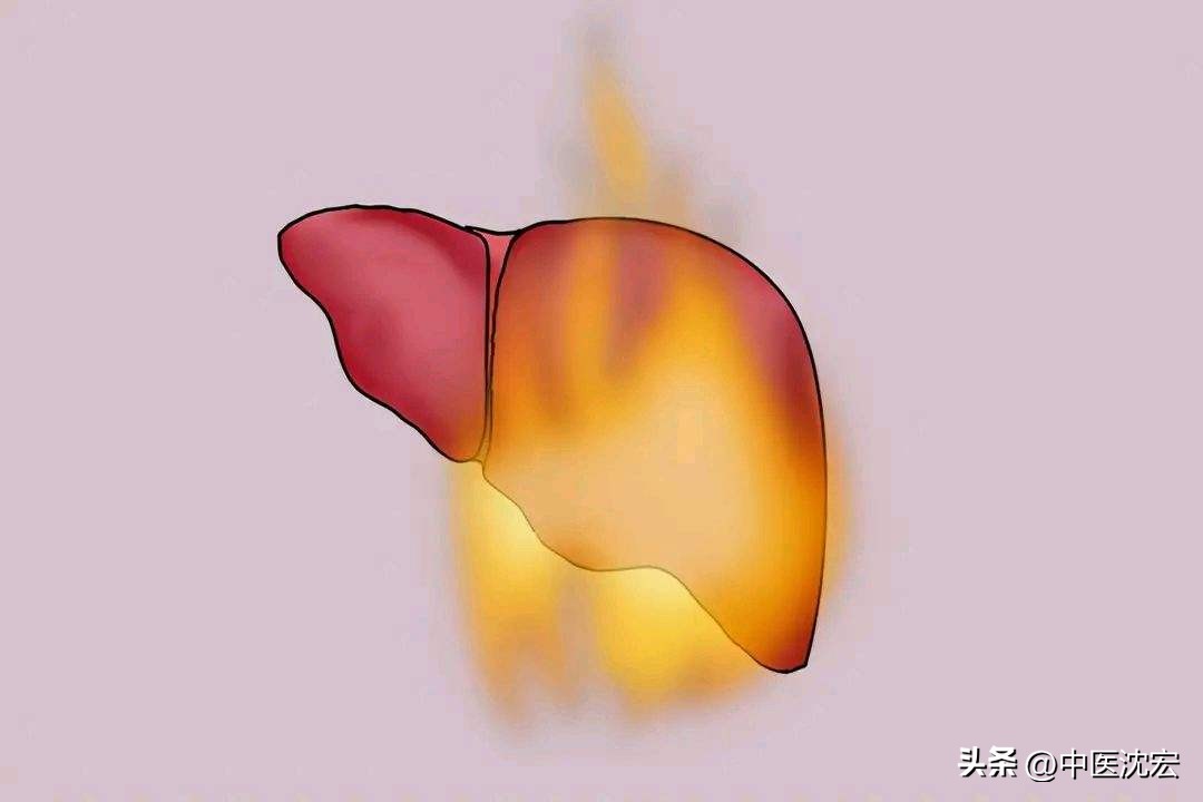 肝火旺吃什么药(肝火旺的最佳食物)