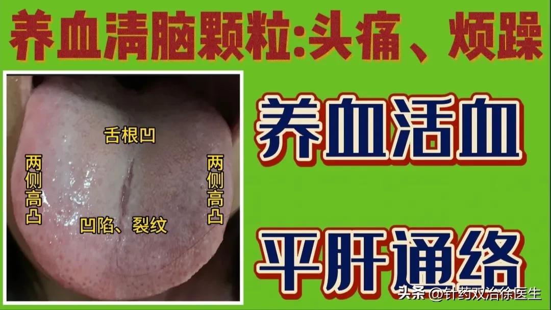 养血清脑颗粒 脑供血不足的症状
