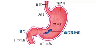 幽门螺旋杆菌吃什么药 幽门菌的作用与功效