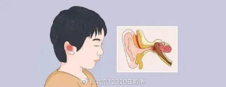 氧氟沙星滴耳液 氧氟沙星滴耳液图片