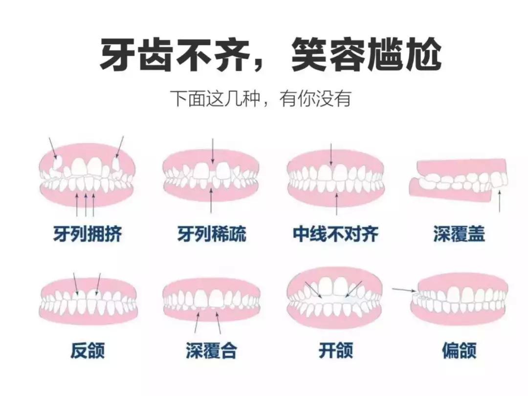 牙齿矫正，为什么价格不一样-儿童牙齿矫正费用