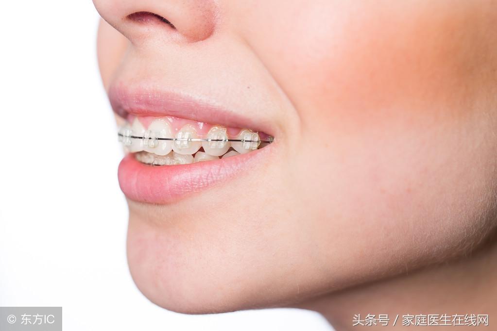 地包天能做手术矫正吗？地包天矫正离不开这6个方法-成人地包天牙齿矫正不手术的病例