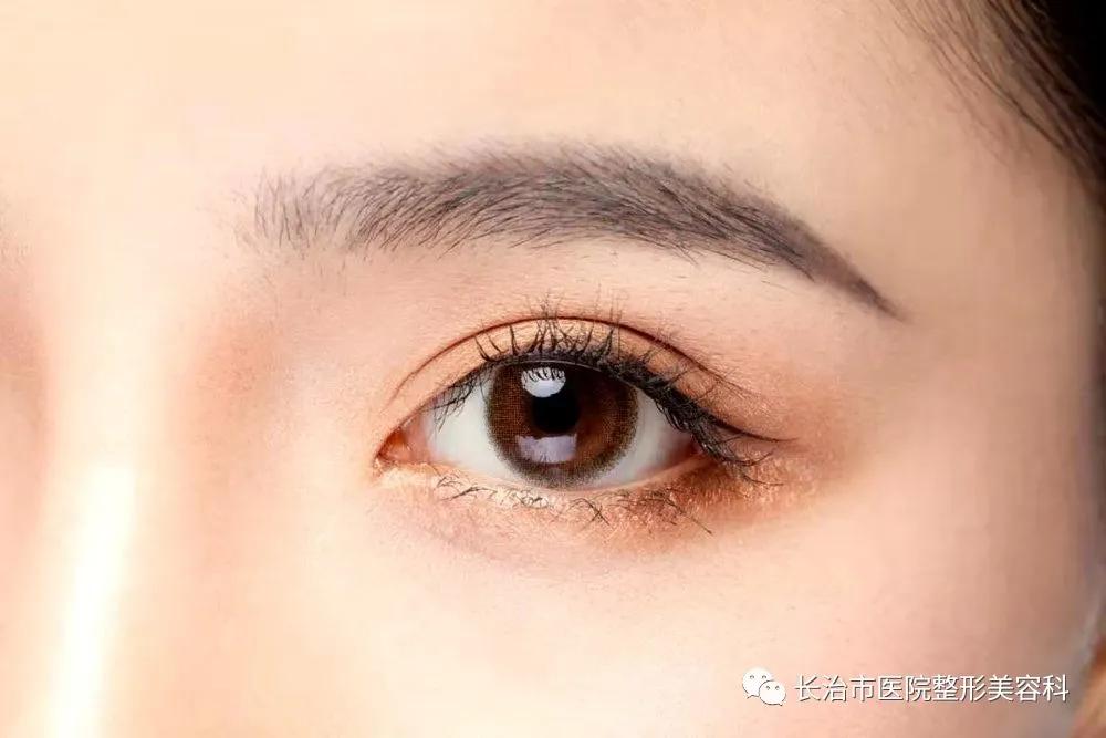 揭秘双眼皮术-闭眼无痕的双眼皮叫什么手术