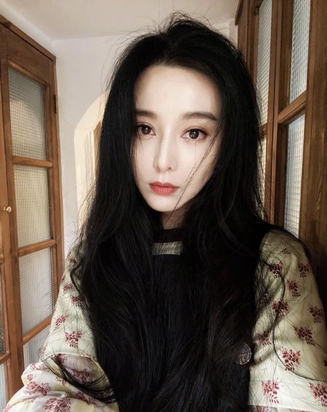 网红揭整容后遗症，额头假体下滑填玻尿酸被撑松，看上去皮肉分离-玻尿酸不打了会不会皮肤很松