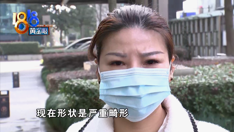 取耳软骨垫鼻尖，鼻子好了耳朵却变形了-耳根骨隆鼻