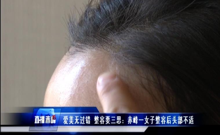 爱美无过错，整容要三思：赤峰一女子整容后头部不适赤峰双眼皮手术好的医生