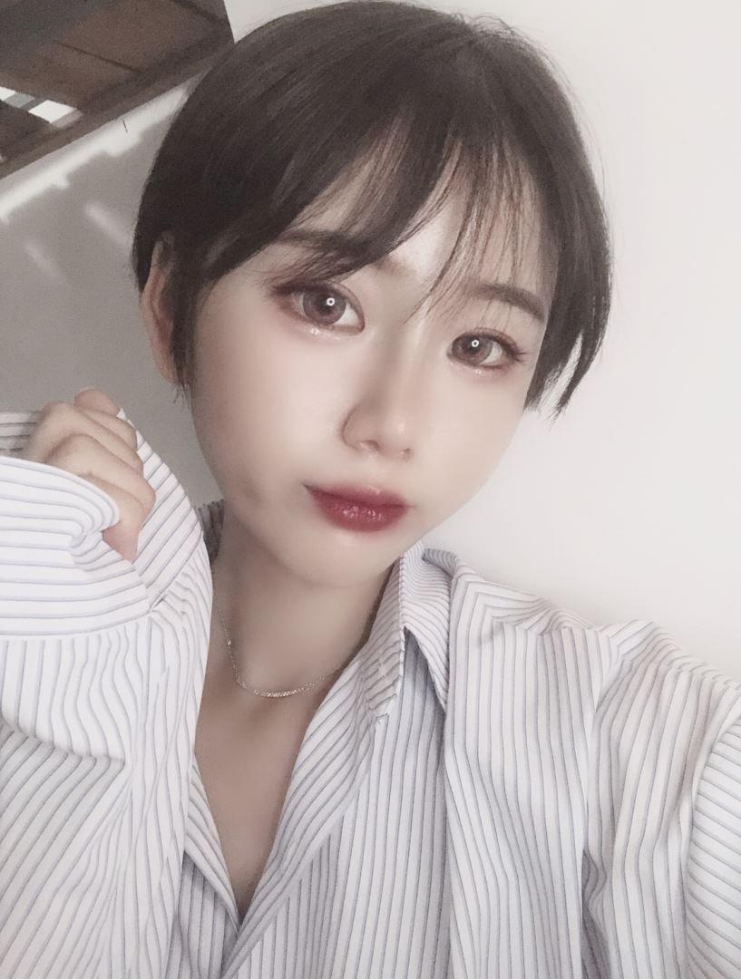 自体脂肪填充和玻尿酸填充的区别自体脂肪填充还是打玻尿酸