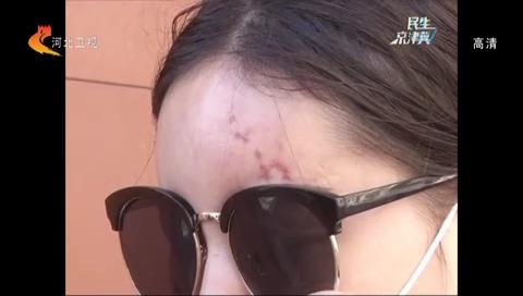 女子打玻尿酸美容后反被“毁容”，医生：已过黄金抢救时间！玻尿酸去除法令纹有什么副作用