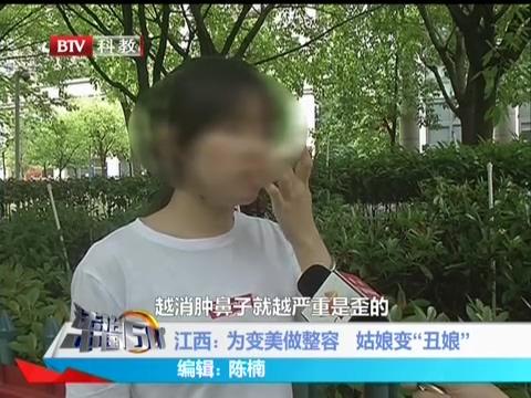 女孩整容后鼻子越消肿越歪，双眼皮也消失了，修复要花8万块-鼻尖整形术费用多少钱