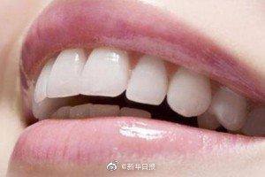 矫正一口牙最高要花十几万，消费者：我好难啊-矫正牙齿大概多少钱