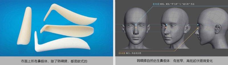 听说这是隆鼻的高“鼻”格-鼻中隔软骨隆鼻