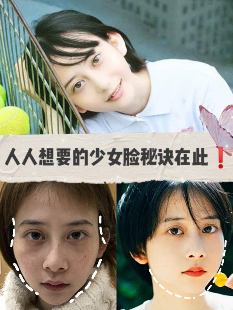 面部填充后，脸上出现了小硬块？响当当的大医院也会手术失败？-自体脂肪填充泪沟需要多次填充吗