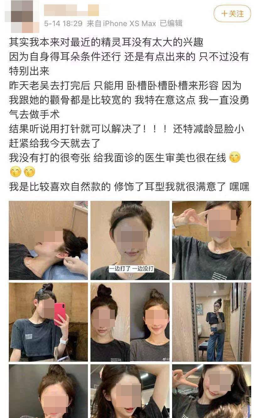 耳朵太小显脸大？还有人到整容医院整出来“精灵耳”玻尿酸填充耳垂多少钱