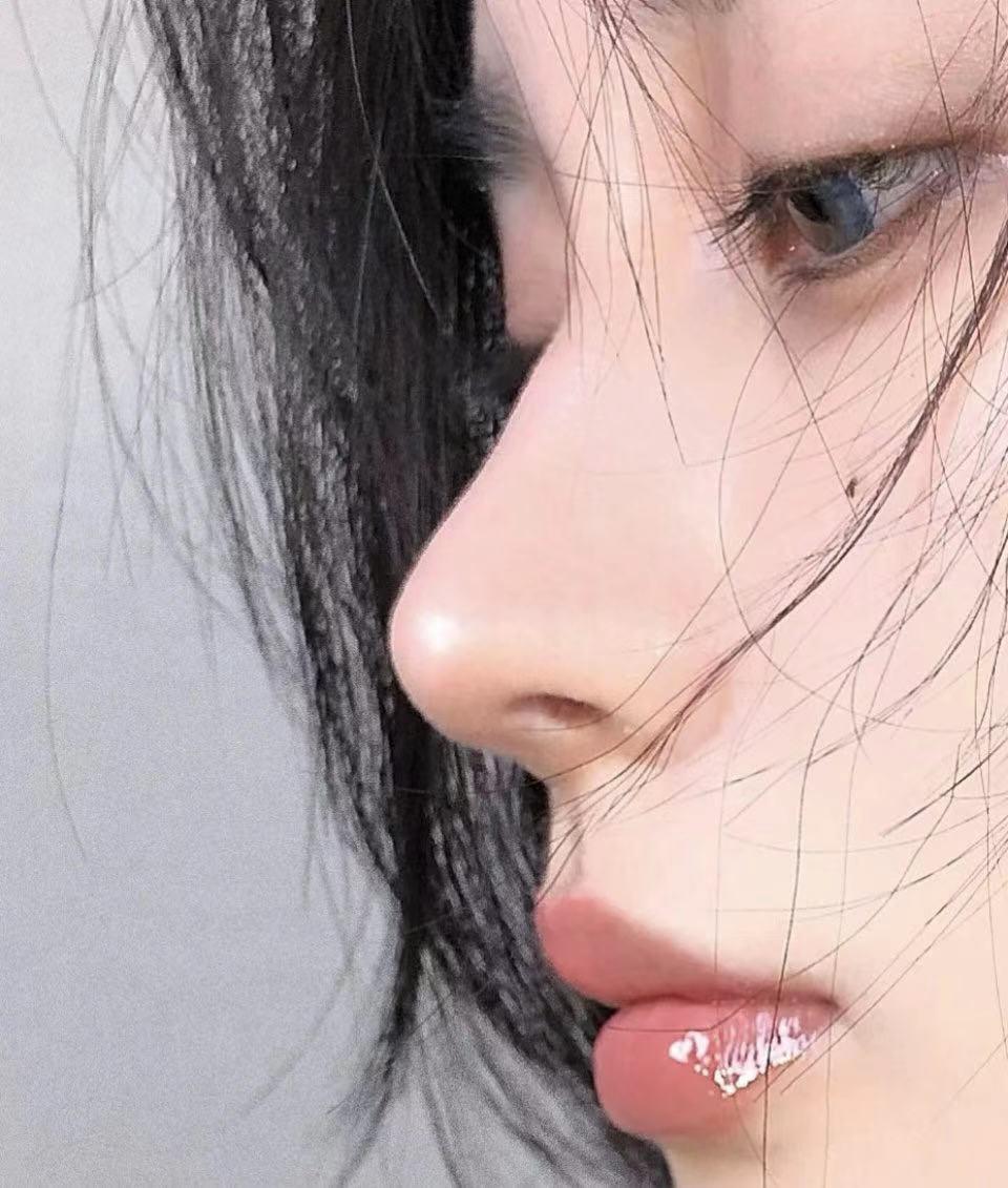 全网最全隆鼻术后-隆鼻拆线疼不疼要多久